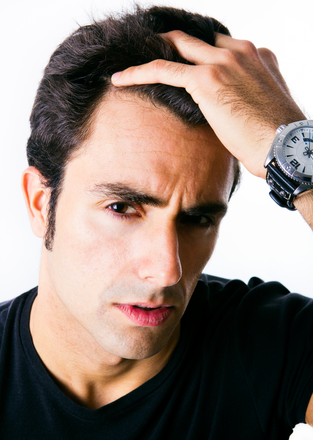 Best Hair Transplant In Jalandhar